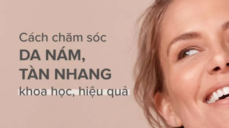 Hướng dẫn chăm sóc da bị nám và tàn nhang khoa học, hiệu quả