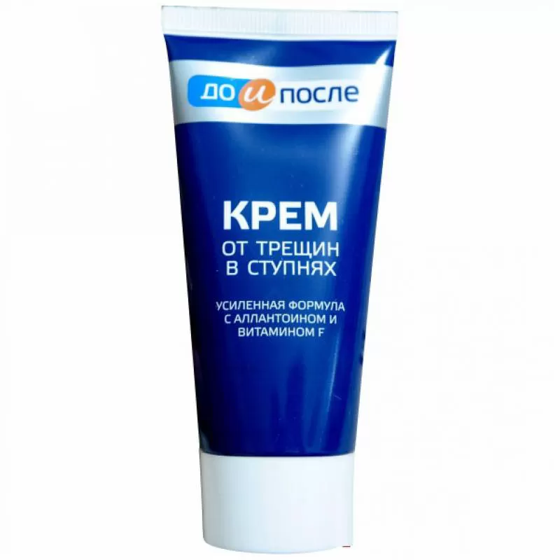 Kem Kpem Apteka Của Nga 50ml – Hỗ Trợ Cải Thiện Nứt Gót Chân