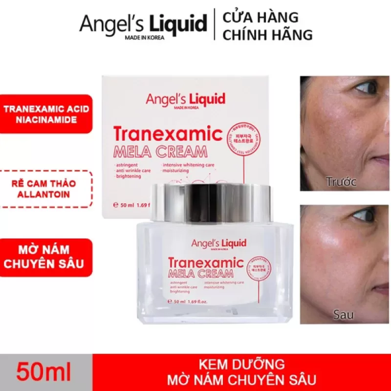 Kem Dưỡng Mờ Nám Chuyên Sâu Angel's Liquid Tranexamic Mela Cream 50ml