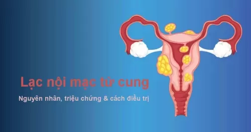 Lạc nội mạc tử cung