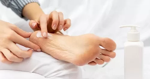 Review 10 Kem Trị Nứt Gót Chân Tốt Nhất 2025